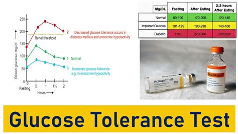 normal glucose tolerance test